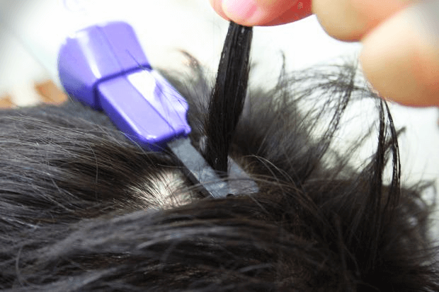 Hair Loss_Hair Thickness Measurement Test Hair Loss Treatment