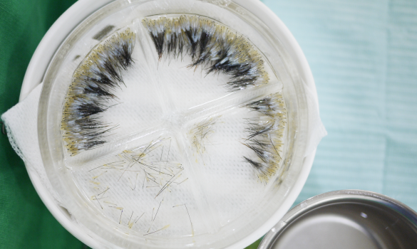 장기 이식 수술과 동일한 수술환경