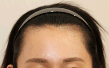 얼굴형, 헤어라인에 구애 없이 완성하는 맞춤형 라인